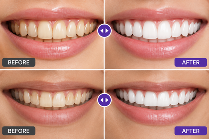 GlowSmile Purple Mouthwash™